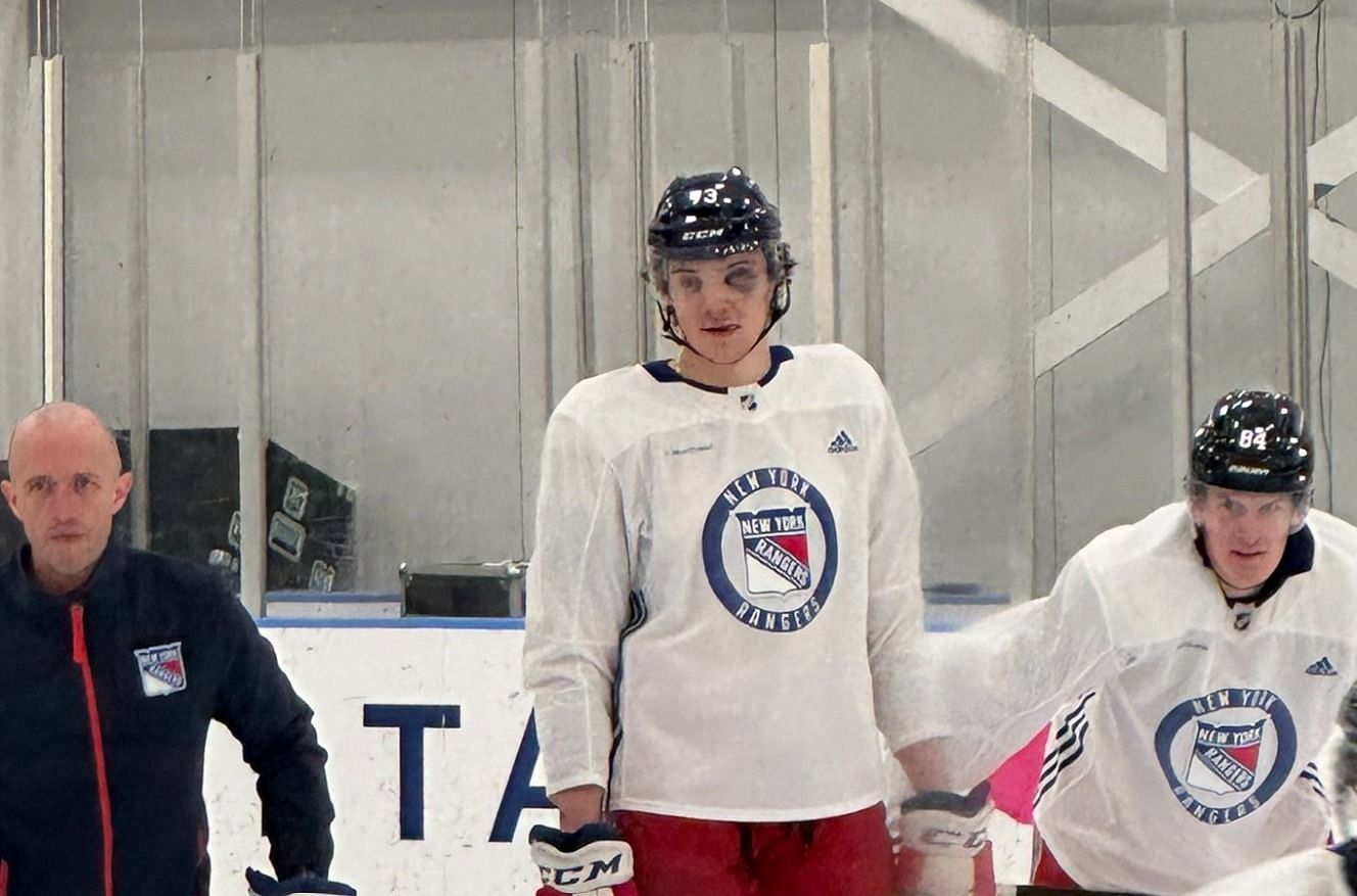 Matt Rempe Black Eye: What Happened and How Bad Is It?