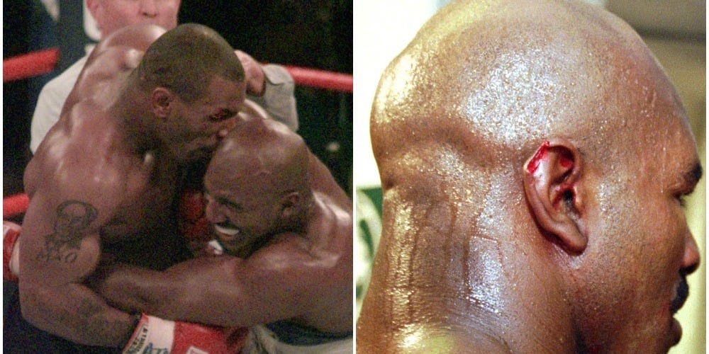 Mike Tysons Infamous Bite: The Story Behind the Time Mike Tyson Bit Someones Ear Off.