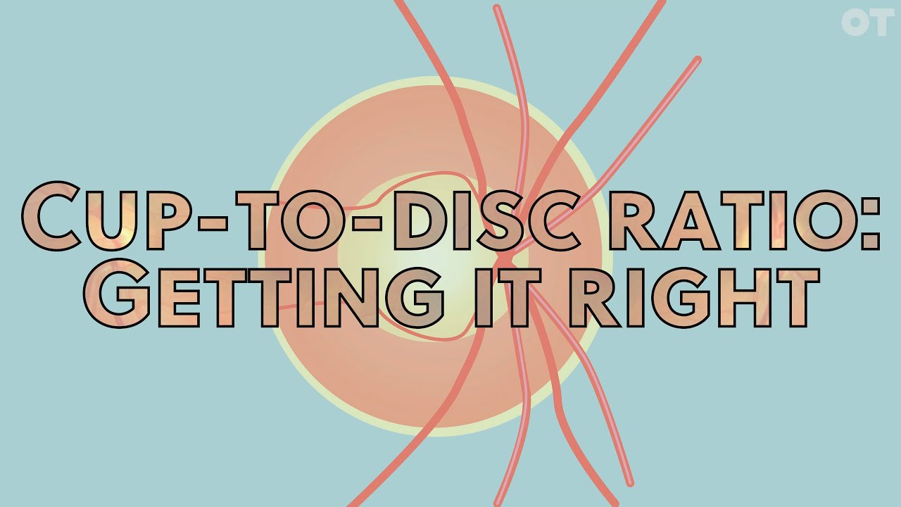 Eye Cup to Disc Ratio Explained: Simple Guide for Beginners