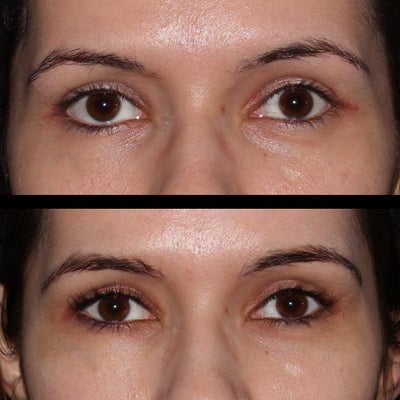 Considering Dr Taban Northridge for your eyes? See what actual patients say in reviews.
