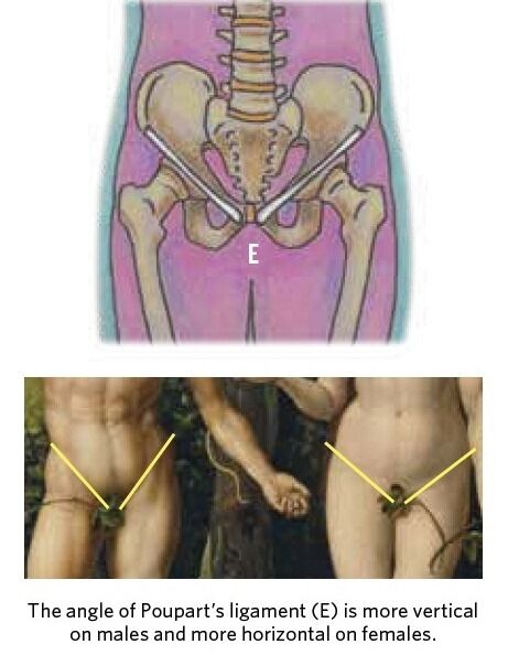 Male with female hips: What does it mean?