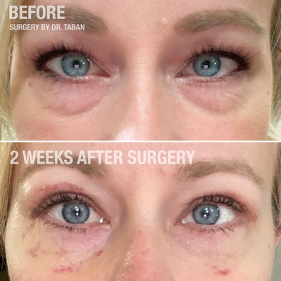 Considering Dr Taban Northridge for your eyes? See what actual patients say in reviews.