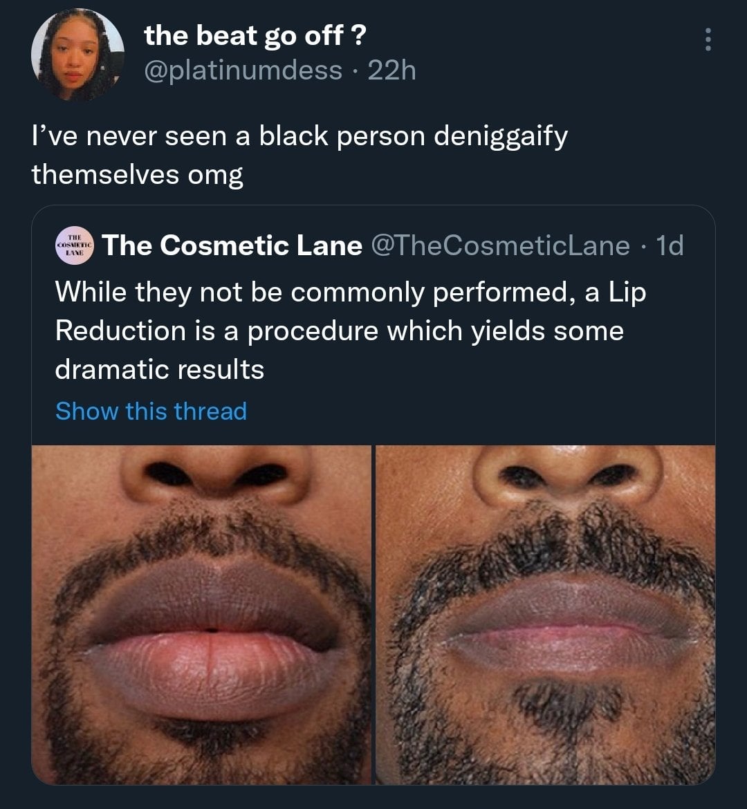 Whats the reason why do blacks have big lips? Here are simple points to know today.