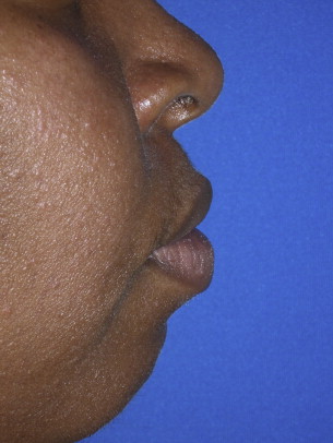 Whats the reason why do blacks have big lips? Here are simple points to know today.