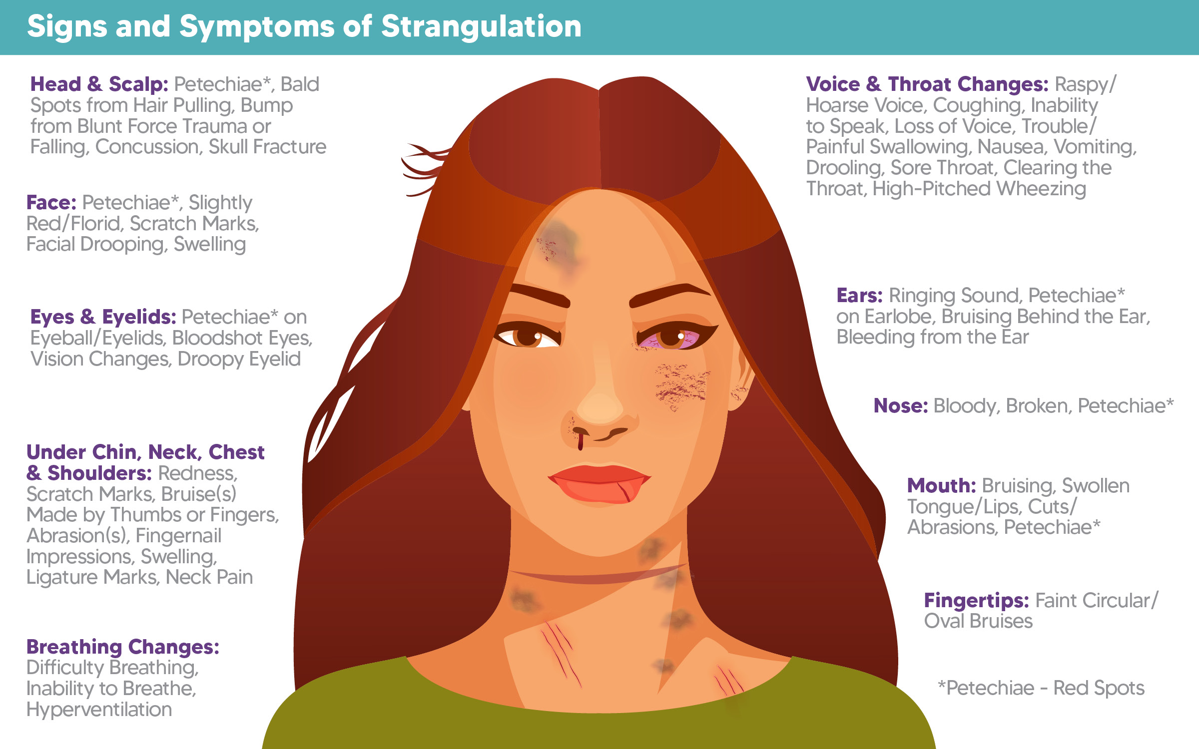 Treating signs of strangulation eyes? Essential first aid steps to know.
